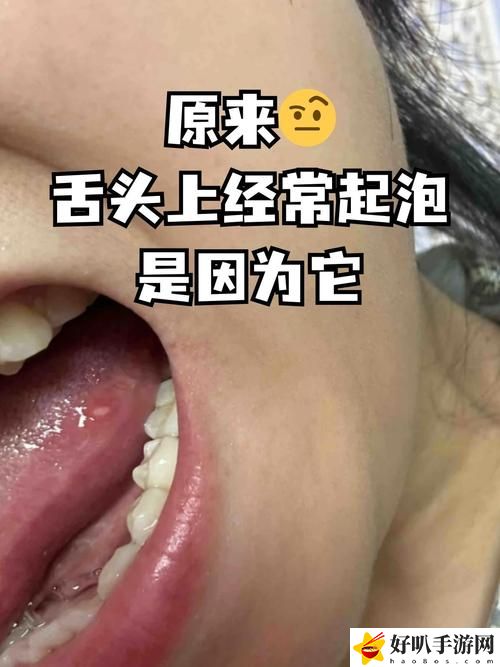 舌头探洞感觉要喷了水怎么回事